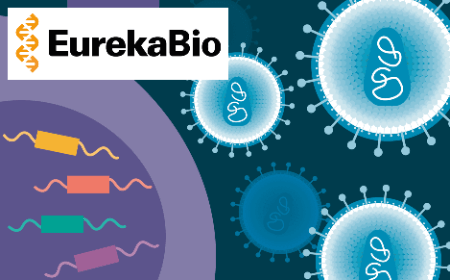 A scalable lentiviral vector production system based on stable producer cell lines 