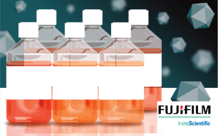 Optimizing HEK293 media for improved titers and VG/Capsid ratios