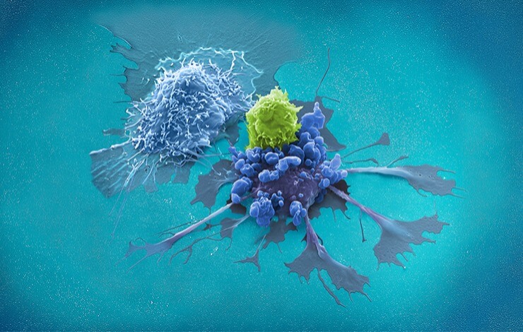 Expand your T cell manufacturing capacities in an automated, closed system to shorten your production time