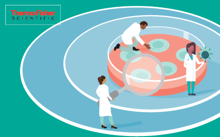Optimizing iPSC-derived cell therapy development  