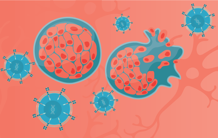 Dual CAR-T therapy targeting solid tumors: insights from intracerebroventricular delivery