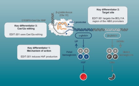 CRISPR gene editing for sickle cell disease: one disease, differentiated approaches