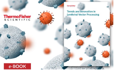 Trends and Innovation in Lentiviral Vector Processing