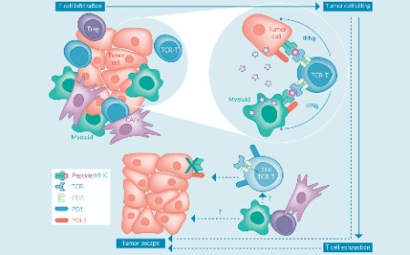 Progress and challenges for T cell receptor engineered T cells for cancer therapy