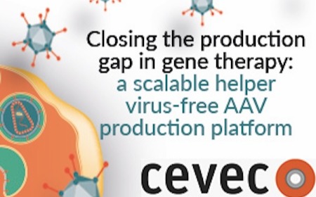 Closing the production gap in gene therapy – A scalable helper virus-free AAV production platform