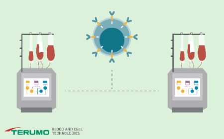 ﻿﻿End-to-end automated manufacturing of low-seed CAR-T cells